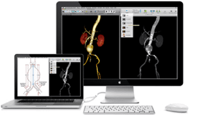 Image: The aycan OsiriX PRO workstation (photo courtesy aycan medical systems).